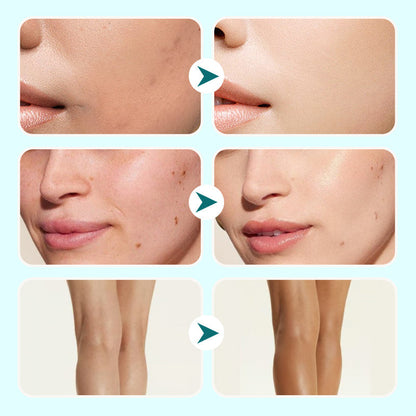 Återfuktande Concealer Vattenfast kräm för kvinno